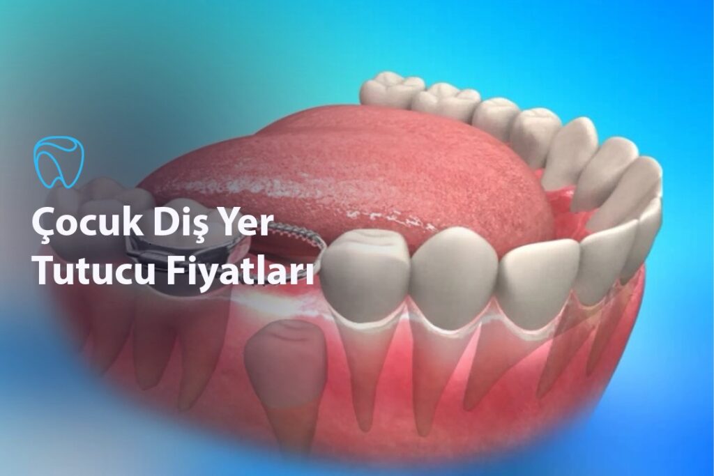 Çocuk Diş Yer Tutucu Fiyatları Çocuk Diş Yer Tutucu Fiyatları