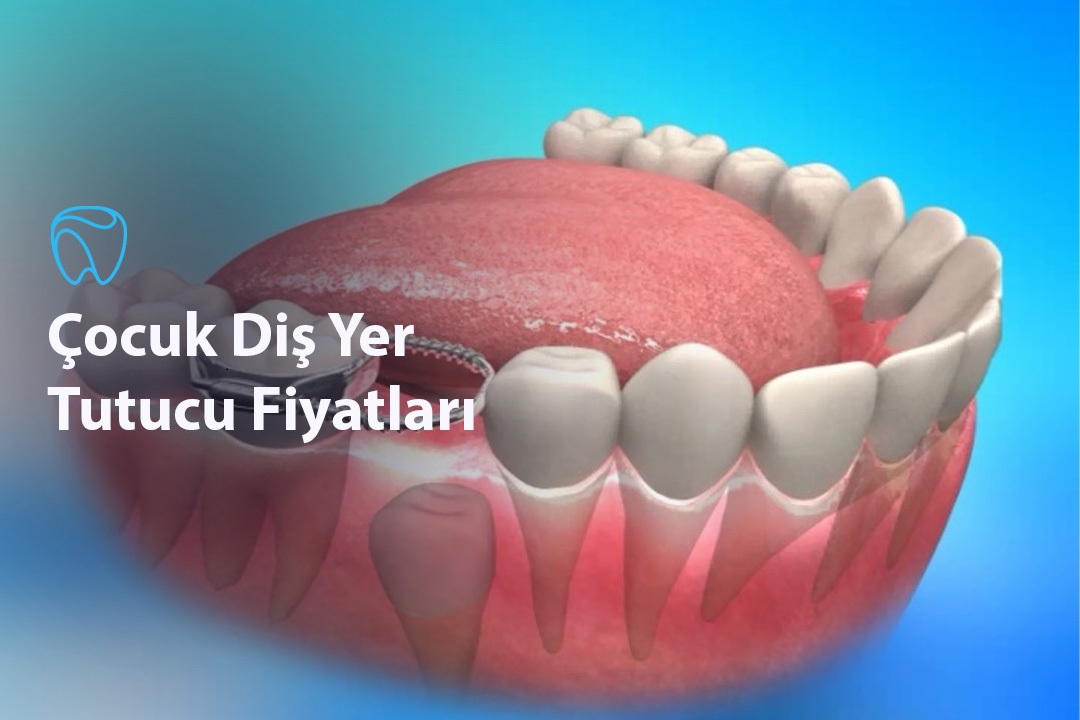 Çocuk Diş Yer Tutucu Fiyatları
