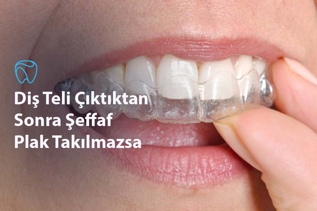 Diş Teli Çıktıktan Sonra Şeffaf Plak Takılmazsa